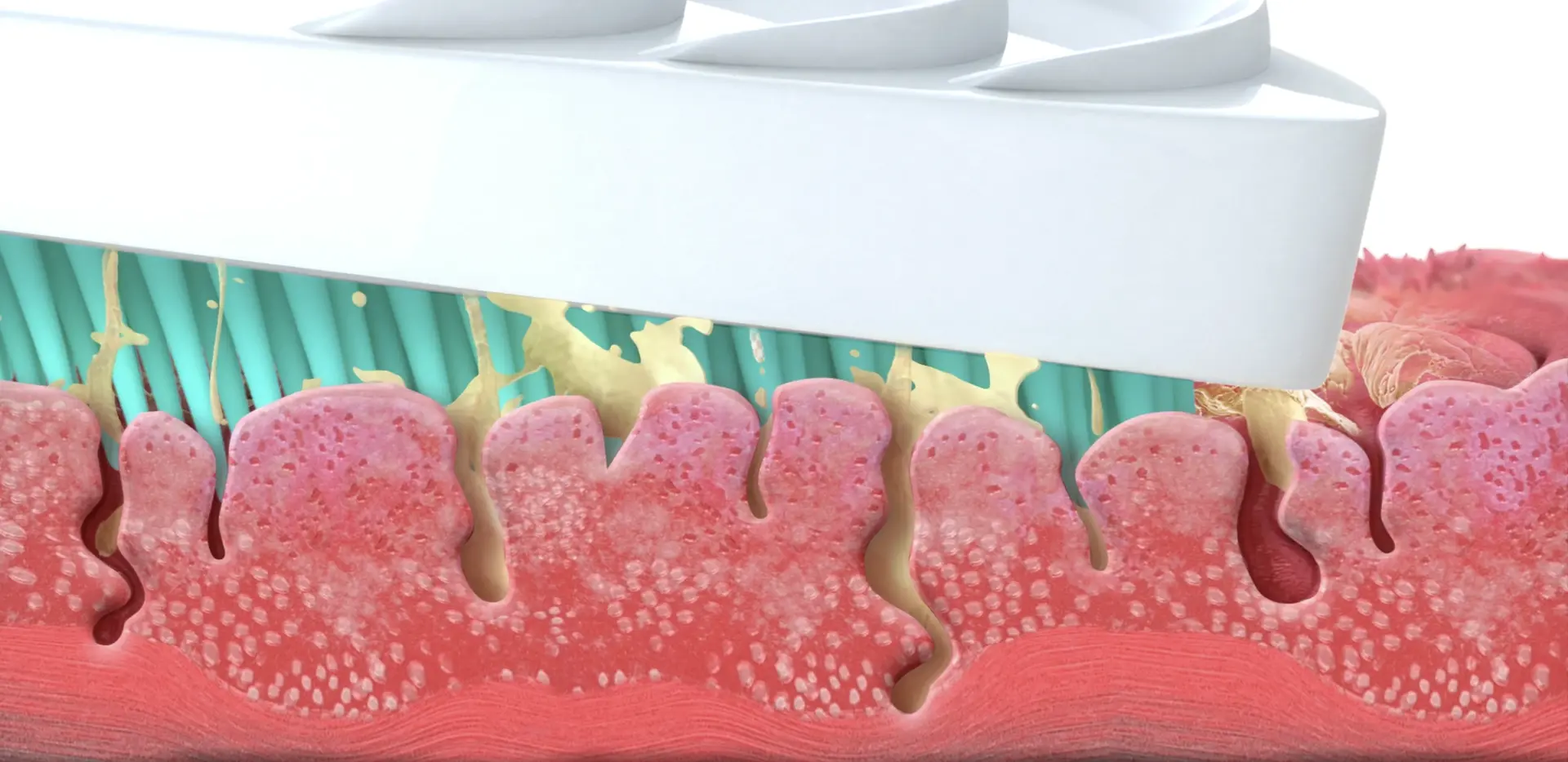  meilleur gratte langue